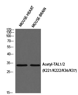 TAL1/2 (Acetyl-Lys221/Lys222/Lys36/Lys37) Colorimetric Cell-Based ELISA Kit