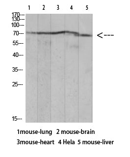 Ku-70 (Acetyl-Lys317) Colorimetric Cell-Based ELISA Kit