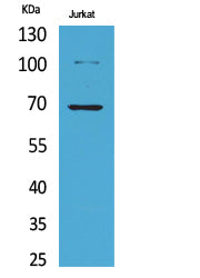 Ku-70 (Acetyl-Lys542) Colorimetric Cell-Based ELISA Kit