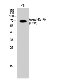 Ku-70 (Acetyl-Lys331) Colorimetric Cell-Based ELISA Kit