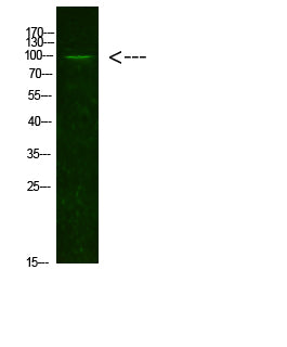 AR(Acetyl-K631) Colorimetric Cell-Based ELISA Kit