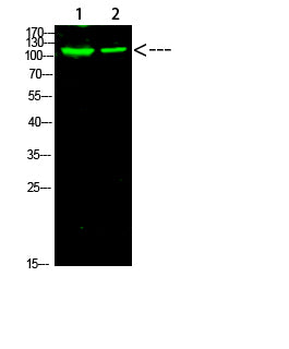 PARP-1 (Acetyl-K521) Colorimetric Cell-Based ELISA Kit
