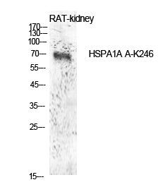 HSP70 (Acetyl-Lys246) Colorimetric Cell-Based ELISA Kit
