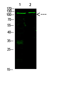 Rb (Acetyl-K873/K874) Colorimetric Cell-Based ELISA Kit