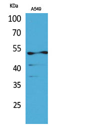 Cytokeratin 8 (Acetyl-Lys483) Colorimetric Cell-Based ELISA Kit