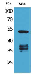 p53 (Acetyl-Lys370) Colorimetric Cell-Based ELISA Kit