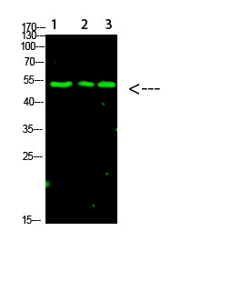 p53 (Acetyl-K120) Colorimetric Cell-Based ELISA Kit