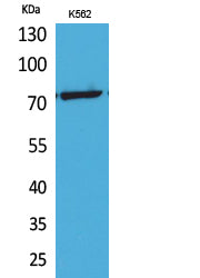 p73 (Acetyl-Lys321) Colorimetric Cell-Based ELISA Kit