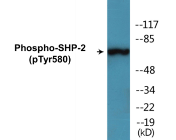 Phospho-SHP-2 (Tyr580) Fluorometric Cell-Based ELISA Kit