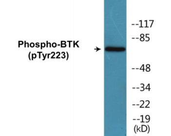Phospho-BTK (Tyr223) Fluorometric Cell-Based ELISA Kit