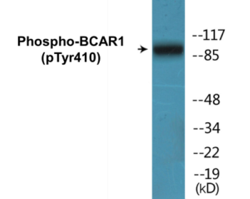 Phospho-BCAR1 (Tyr410) Fluorometric Cell-Based ELISA Kit