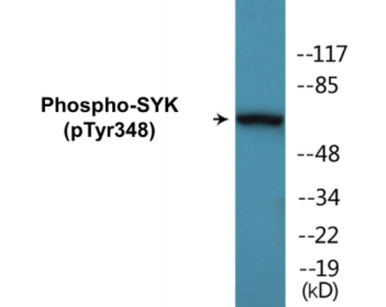 Phospho-SYK (Tyr348) Fluorometric Cell-Based ELISA Kit
