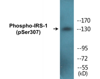 Phospho-IRS-1 (Ser307) Fluorometric Cell-Based ELISA Kit