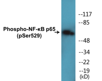 Phospho-NF-κB p65 (Ser529) Fluorometric Cell-Based ELISA Kit