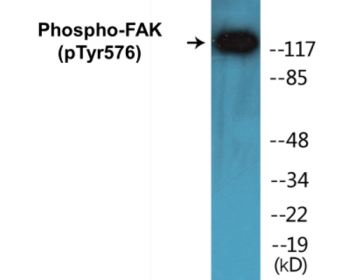 Phospho-FAK (Tyr576) Fluorometric Cell-Based ELISA Kit
