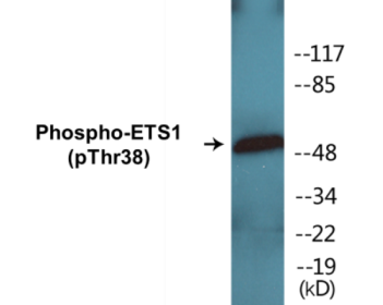 Phospho-ETS1 (Thr38) Fluorometric Cell-Based ELISA Kit