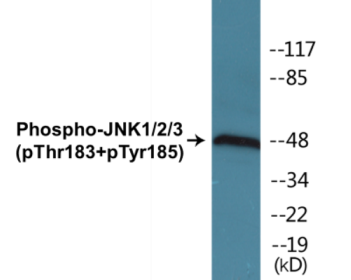 Phospho-JNK1/2/3 (Thr183+Tyr185) Fluorometric Cell-Based ELISA Kit