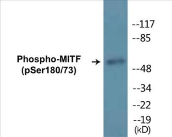 Phospho-MITF (Ser180/73) Fluorometric Cell-Based ELISA Kit