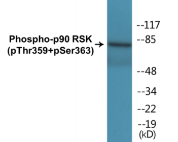 Phospho-p90 RSK (Thr359+Ser363) Fluorometric Cell-Based ELISA Kit