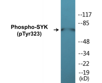 Phospho-SYK (Tyr323) Fluorometric Cell-Based ELISA Kit