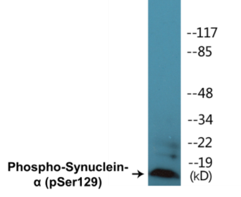 Phospho-Synuclein-alpha (Ser129) Fluorometric Cell-Based ELISA Kit