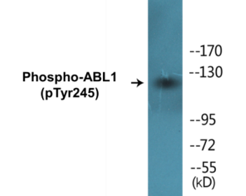 Phospho-ABL1 (Tyr245) Fluorometric Cell-Based ELISA Kit
