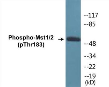 Phospho-Mst1/2 (Thr183) Fluorometric Cell-Based ELISA Kit