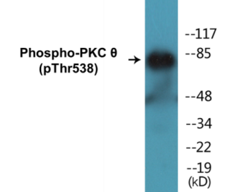 Phospho-PKC theta (Thr538) Fluorometric Cell-Based ELISA Kit