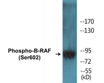 Phospho-B-RAF (Ser602) Fluorometric Cell-Based ELISA Kit