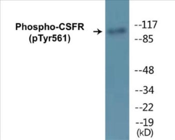 Phospho-CSFR (Tyr561) Fluorometric Cell-Based ELISA Kit