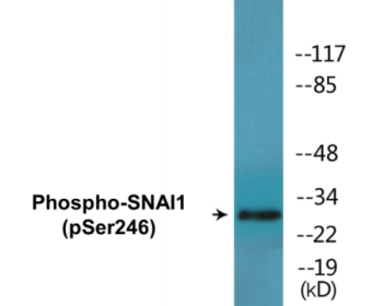 Phospho-SNAI1 (Ser246) Fluorometric Cell-Based ELISA Kit