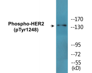 Phospho-HER2 (Tyr1248) Fluorometric Cell-Based ELISA Kit