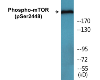 Phospho-mTOR (Ser2448) Fluorometric Cell-Based ELISA Kit