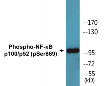 Phospho-NF-κB p100/p52 (Ser869) Fluorometric Cell-Based ELISA Kit