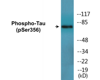 Phospho-Tau (Ser356) Fluorometric Cell-Based ELISA Kit