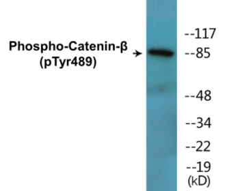 Phospho-Catenin-beta (Tyr489) Fluorometric Cell-Based ELISA Kit