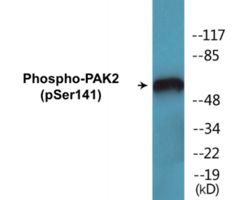 Phospho-PAK2 (Ser141) Fluorometric Cell-Based ELISA Kit