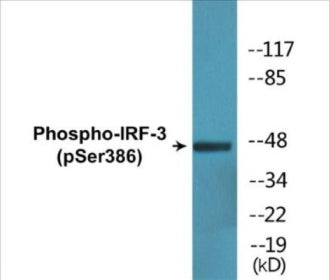 Phospho-IRF-3 (Ser386) Fluorometric Cell-Based ELISA Kit