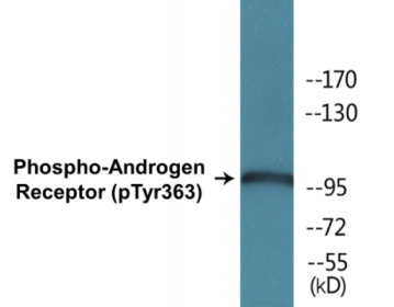 Phospho-Androgen Receptor (Tyr363) Fluorometric Cell-Based ELISA Kit