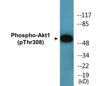 Phospho-Akt1 (Thr308) Fluorometric Cell-Based ELISA Kit