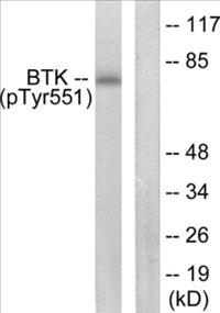 Phospho-BTK (Tyr551) Fluorometric Cell-Based ELISA Kit