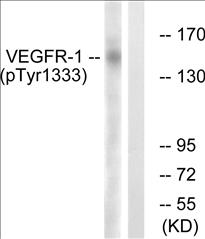 Phospho-VEGFR1 (Tyr1333) Fluorometric Cell-Based ELISA Kit
