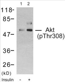 Phospho-Akt (Thr308) Fluorometric Cell-Based ELISA Kit