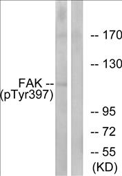 Phospho-FAK (Tyr397) Fluorometric Cell-Based ELISA Kit