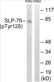 Phospho-SLP-76 (Tyr128) Fluorometric Cell-Based ELISA Kit