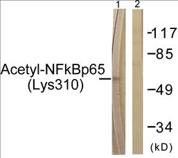 Acetyl-NF-kappa p65 (Lys310) Fluorometric Cell-Based ELISA Kit