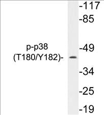 Phospho-p38 (Thr180/Tyr182) Fluorometric Cell-Based ELISA Kit